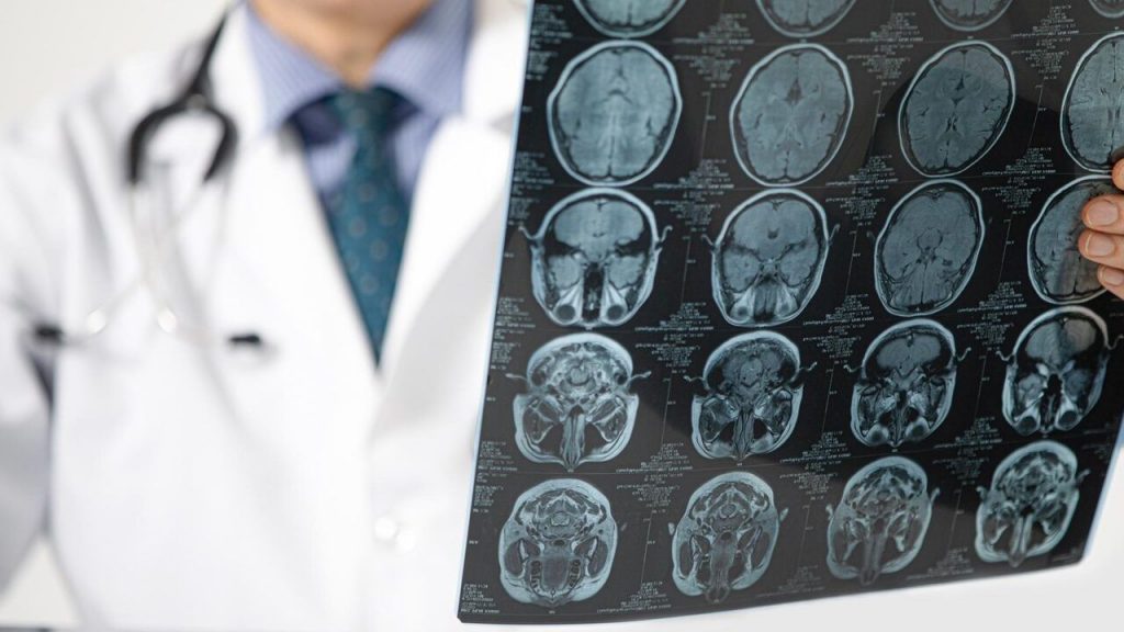 Pandemi beyni yaşlandırdı: Covid olmasanız bile etkilenmiş olabilirsiniz